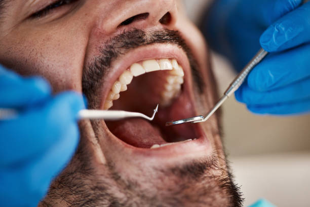 Best Emergency Tooth Extraction in Timberville, VA